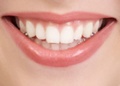 White-teeth.jpg