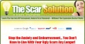 Scar removal cream.jpeg