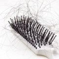 Hair-loss-women.jpg