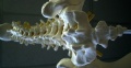 Chiropractic austin-jurvetson-600x4731-resized.jpg