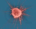 Cancer-cell.jpeg